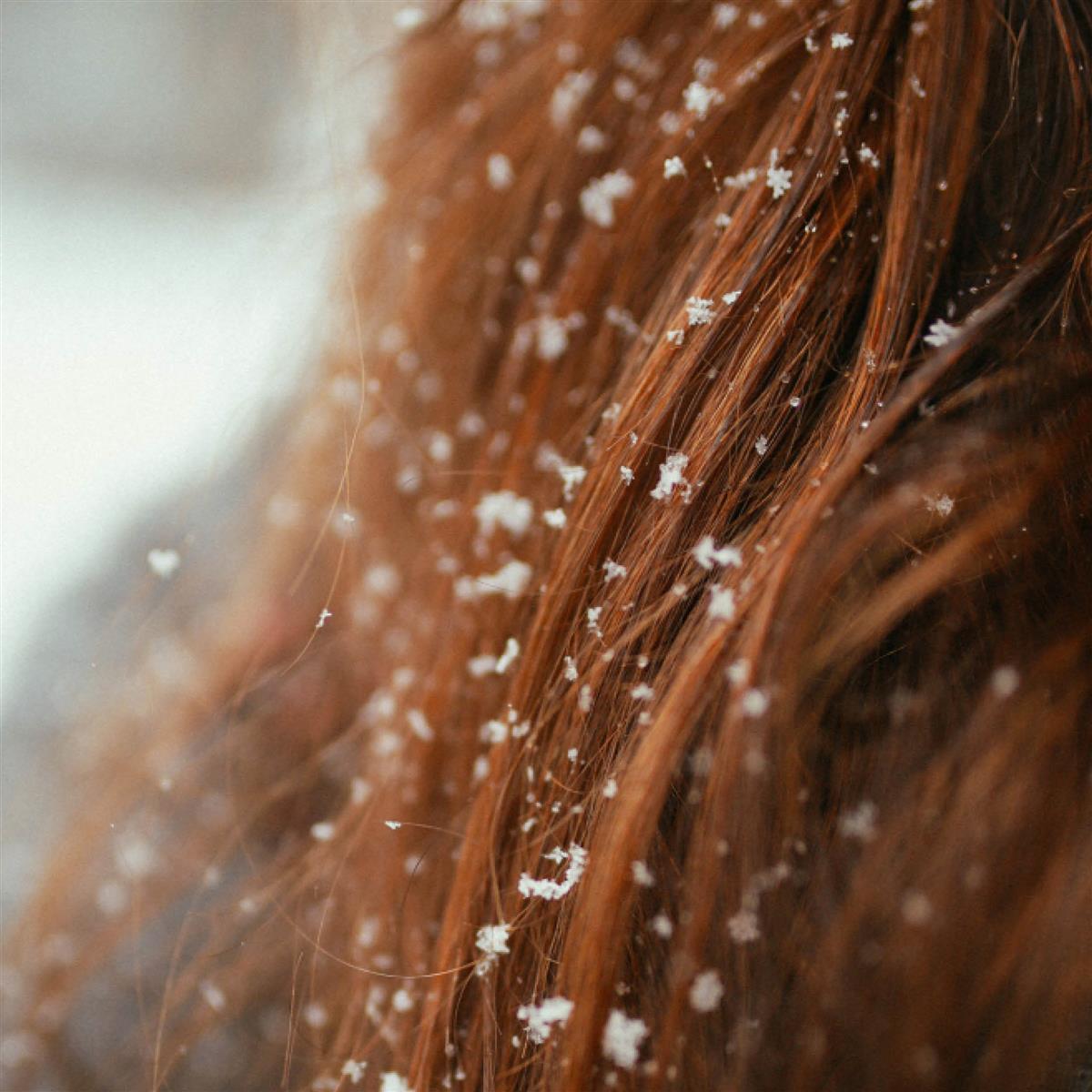 Vinterglød til tørt hår